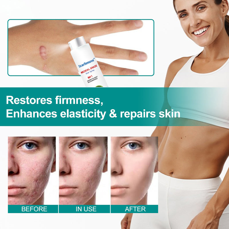 ScarRemove™ Scar and Stretch Mark Refining Spray