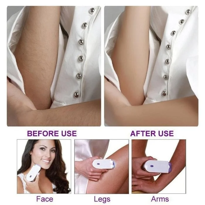Seurico™ BIG SALE 50% OFF Silky Smooth Hair Eraser