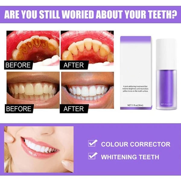 Smilekit™ New V34 Series Toothpaste Purple Color Corrector