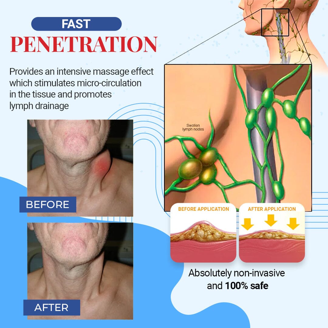 Fivfivgo™ Patches on the lymph nodes of the thyroid gland