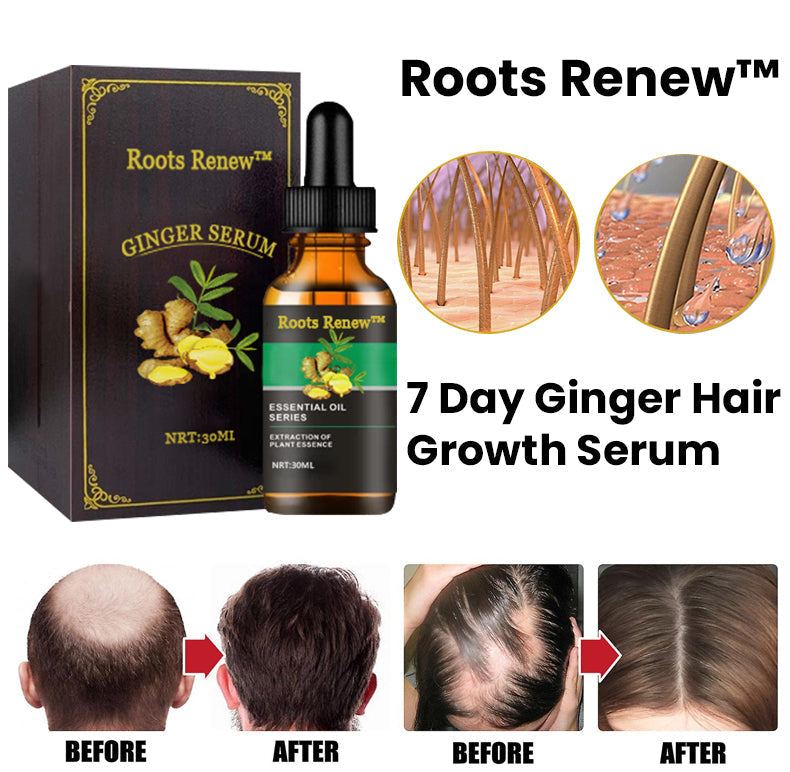Roots Renew™ Ginger Hair Growth Serum 5% Minoxidil