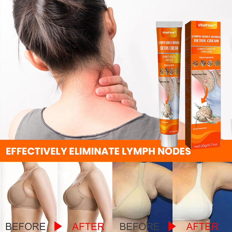 VitalFlow™ Herbal Lymphatic Detox Cream