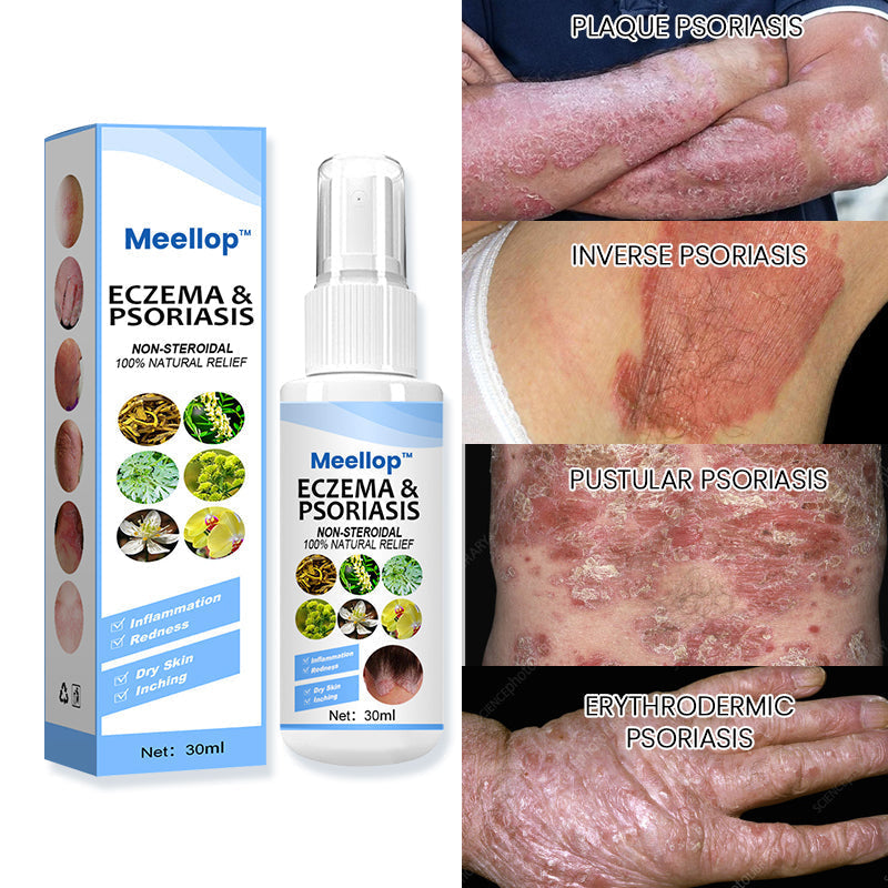 Meellop™ Psoriasis Treatment Spray💖