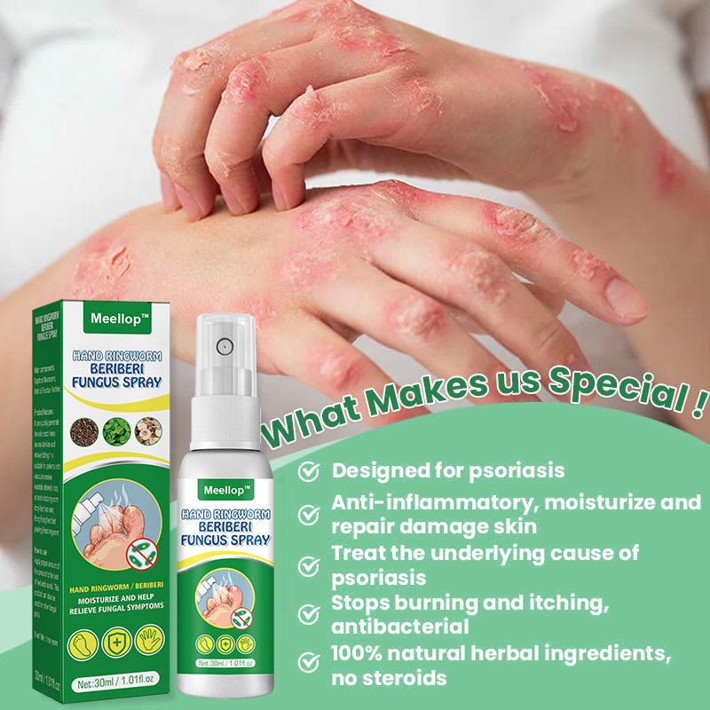 Meellop™ Herbal Psoriasis Relief Spray