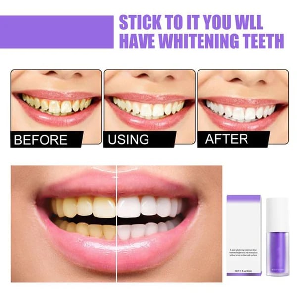 Smilekit™ New V34 Series Toothpaste Purple Color Corrector