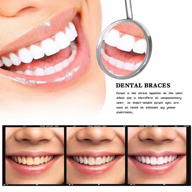 Smilekit™ New V34 Series Toothpaste Purple Color Corrector