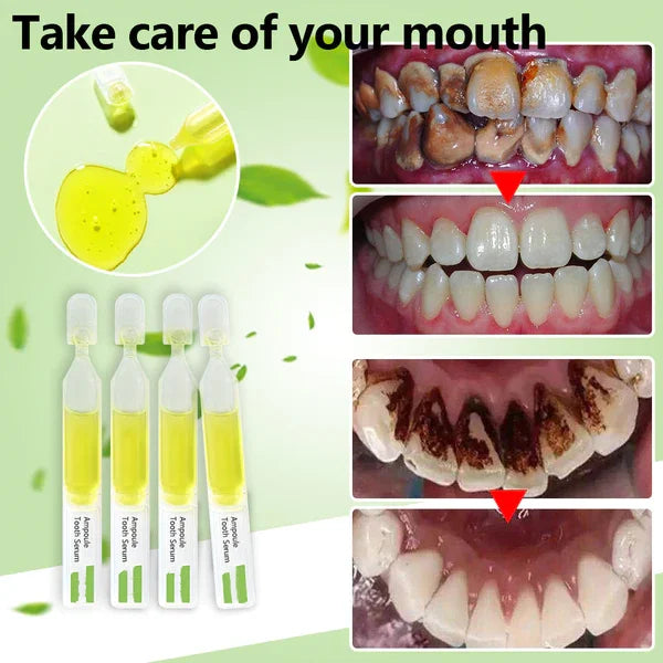 SmileMate™ Removal of tartar and plaque bacteria and various oral problems