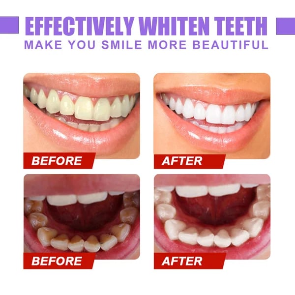 Smilekit™ New V34 Series Toothpaste Purple Color Corrector