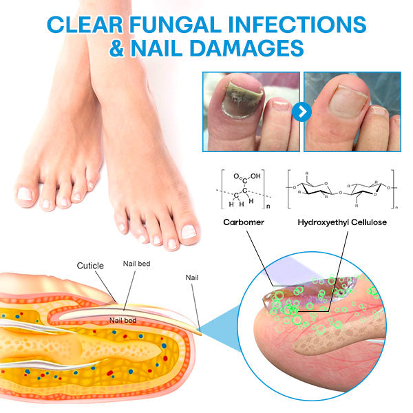 Seurich™ Pure Advance Light FootFix Device
