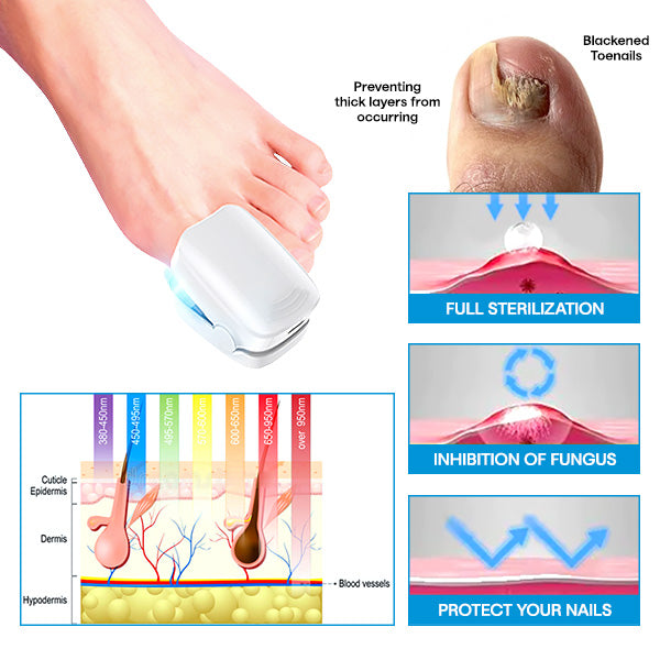 Seurich™ Pure Advance Light FootFix Device