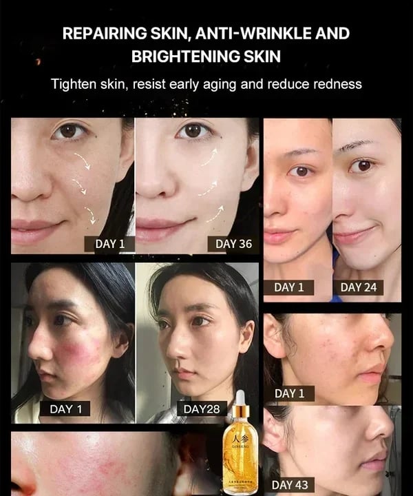 š„LAST DAY 70% OFFš„ Ginseng Polypeptide Anti-Ageing Essence