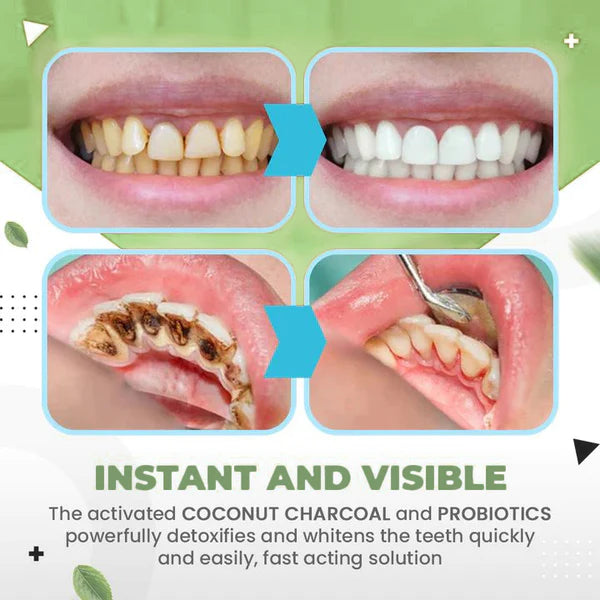 SmileMate™ Removal of tartar and plaque bacteria and various oral problems