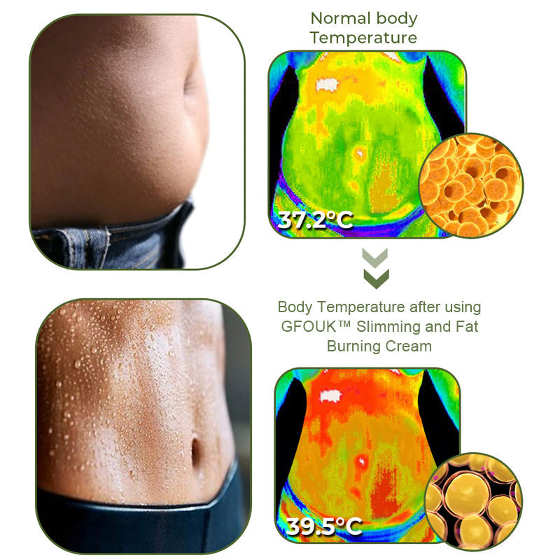 GFOUK™ Slimming and Fat Burning Cream