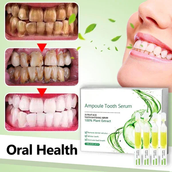 SmileMate™ Removal of tartar and plaque bacteria and various oral problems
