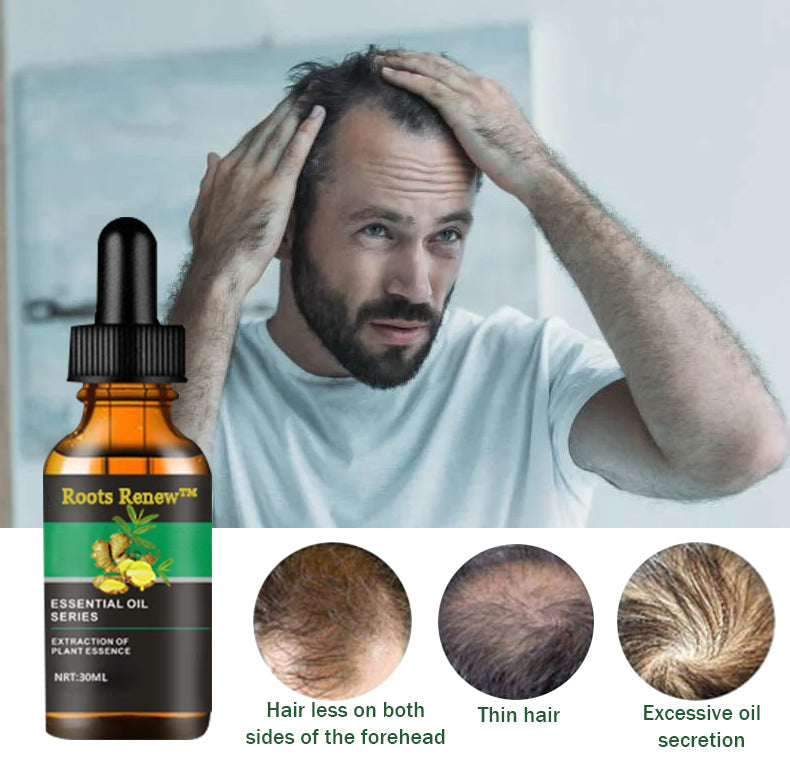 Roots Renew™ Ginger Hair Growth Serum 5% Minoxidil