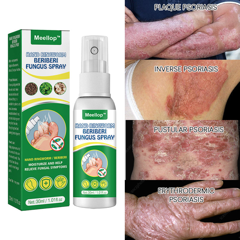 Meellop™ Herbal Psoriasis Relief Spray