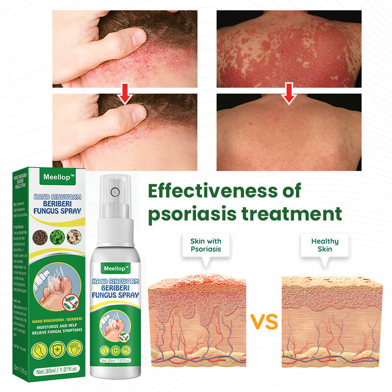 Meellop™ Herbal Psoriasis Relief Spray