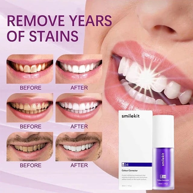Smilekit™ New V34 Series Toothpaste Purple Color Corrector